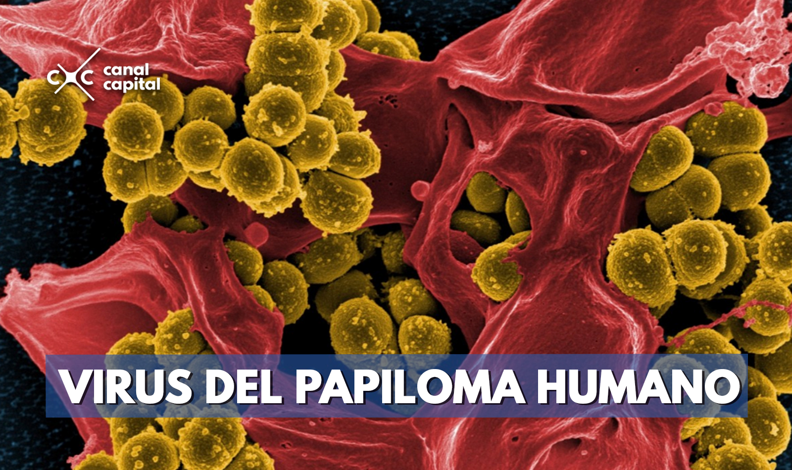 Virus Del Papiloma Humano Un Enemigo Que Se Puede Convertir En C Ncer