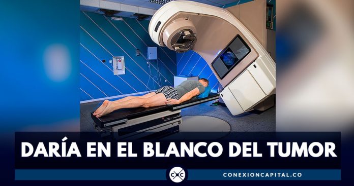 técnica de radioterapia en colombia