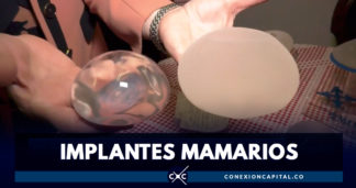 En Colombia, hay más de 900 reportes por problemas relacionados con implantes mamarios